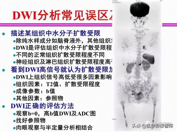 臨床MRI訊號分析基礎：常規序列及DWI序列
