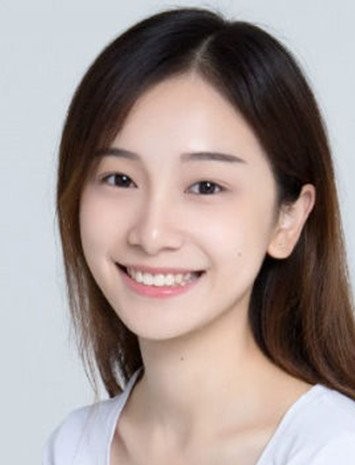 5位瘦成皮包骨的明星,不分男女的減肥,當真要錢不要命? 5位瘦成皮包骨的明星,不分男女的減肥,當真要錢不要命?