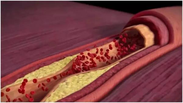 陳醋、米醋、白醋……原來差別這麼大!挑選時關鍵看這2點,快速避開雷區 陳醋、米醋、白醋……原來差別這麼大!挑選時關鍵看這2點,快速避開雷區