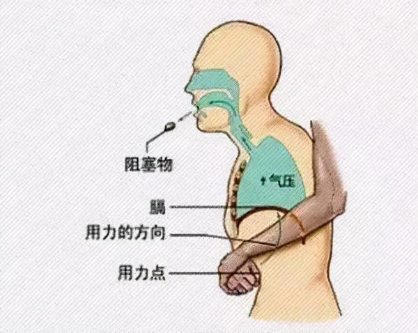 耳鼻喉科三大急症，堪比心腦疾病，最要命