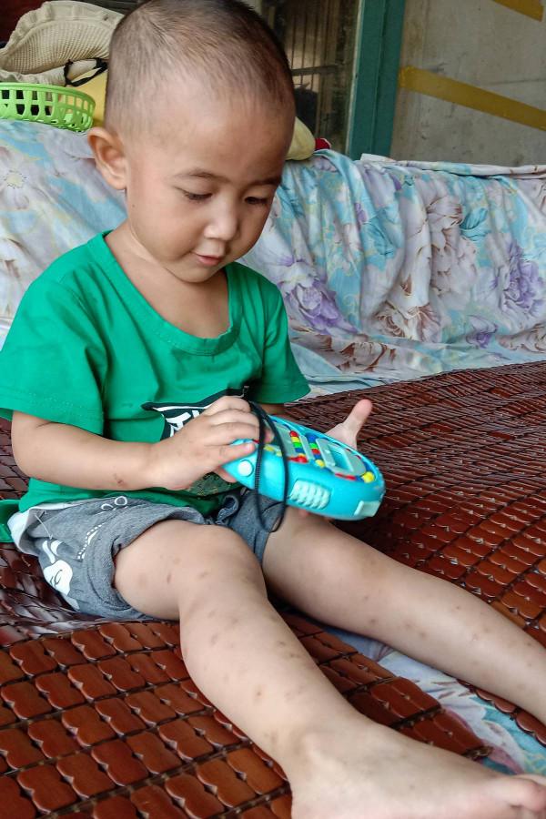 兒女雙全讓父母歡天喜地,誰料不久後卻遭無情打擊,女兒患了重症 兒女雙全讓父母歡天喜地,誰料不久後卻遭無情打擊,女兒患了重症