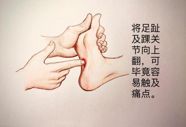 簡明足底筋膜炎診治指南