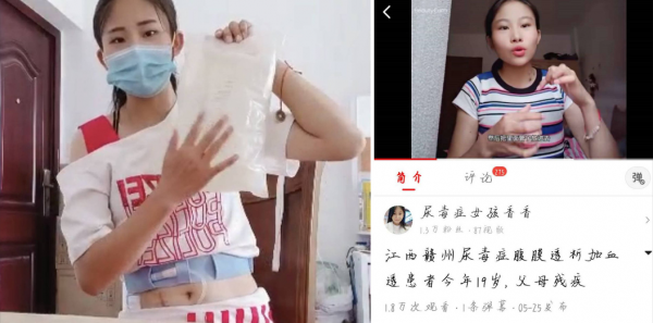 2020年19歲女孩患尿毒症，被親媽拉黑，親爸留下1000元：你多保重