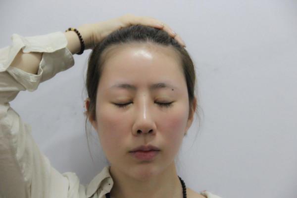 32歲寶媽自體脂肪填充50天，親戚以為我悄悄地換了一張臉