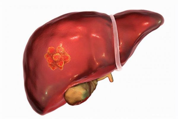 半夜突然口乾舌燥？別以為是缺水，或是這幾種症狀的“警告”