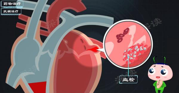 這種藥既能降血壓又能治房顫，房顫治療又有黑科技