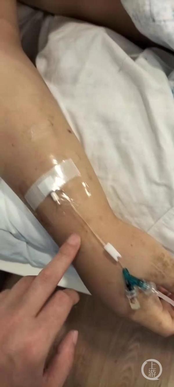 江蘇小夥在柬埔寨被多次抽血全身浮腫病危，大使館警方已介入