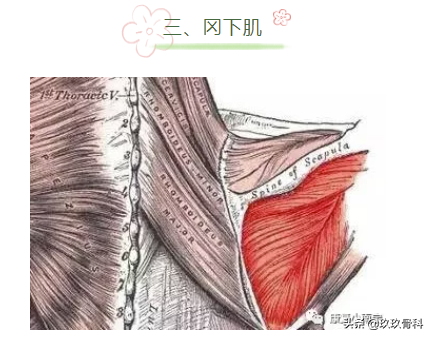 收藏 | 引發肩關節疼痛的肌肉彙總