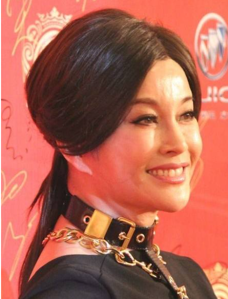 越整越難看後遺症一堆的9位女星！臉像鞋拔子，不敢做大表情