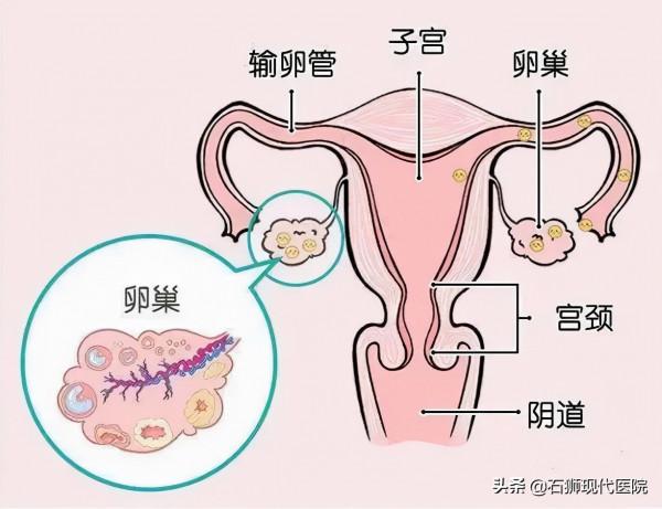 女性4大腫瘤危及生命健康，定期體檢切勿忽視