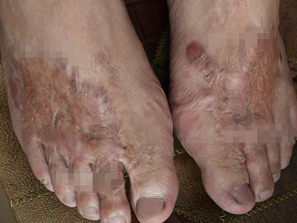 2003年工人挖出5個日軍遺留鐵桶，致1死43中毒，日本賠了多少錢？