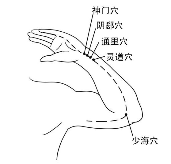 被人們忽略的中風先兆 被人們忽略的中風先兆