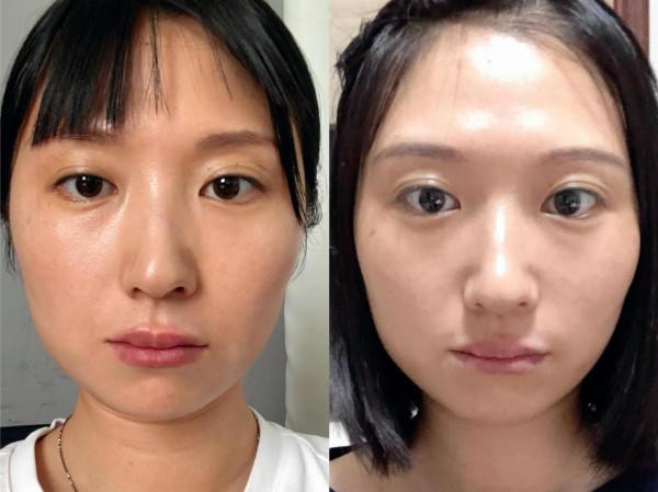 面部瑜伽鍛鍊一個月效果 面部瑜伽鍛鍊一個月效果