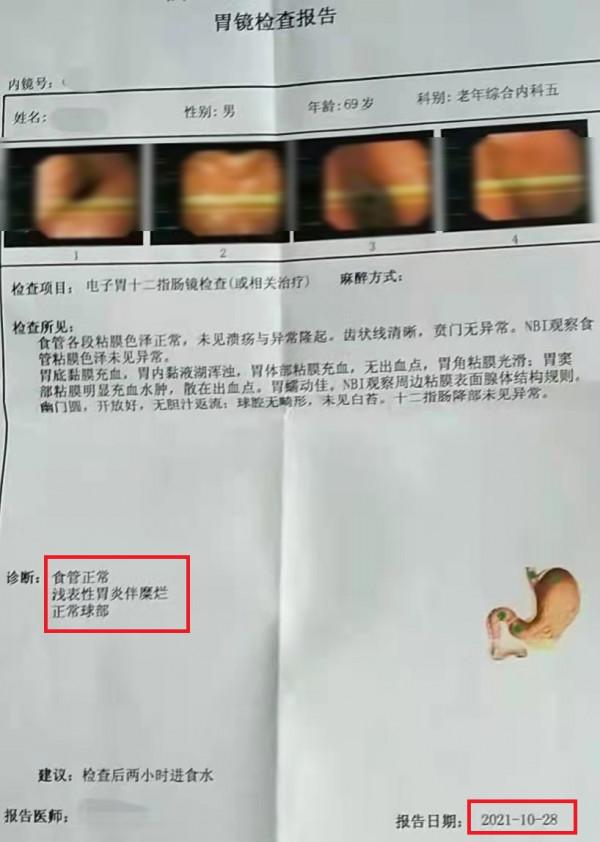 萎縮性胃炎伴腸化不可逆？69歲老者中藥調治4個月，成功逆襲