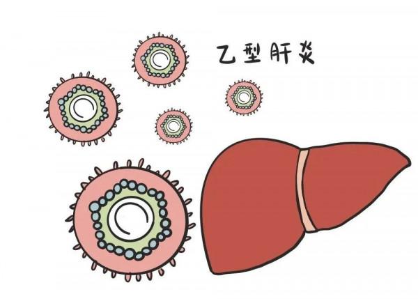 慢性乙肝自然恢復的三種可能