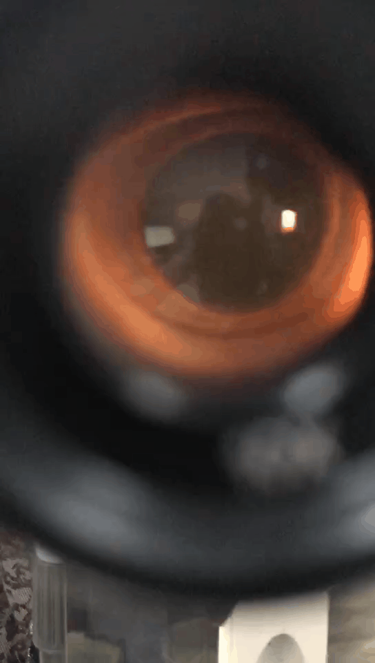 眼睛前面總有黑點跑來跑去，是什麼原因？會不會瞎掉？