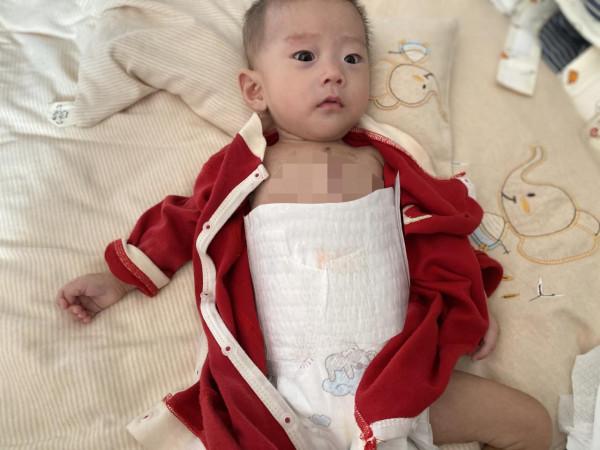 5個月產檢發現問題,夫妻不忍放棄,雙胞胎姐妹出生結果喜憂參半 5個月產檢發現問題,夫妻不忍放棄,雙胞胎姐妹出生結果喜憂參半