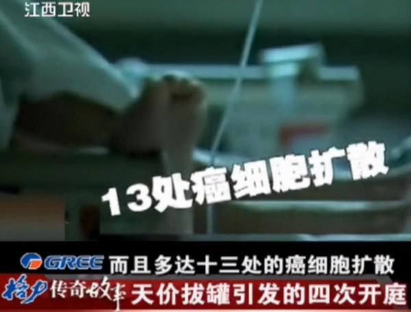 大叔肝癌晚期，花60萬拔罐病情加重身亡，法庭上拔罐者竟大呼冤枉