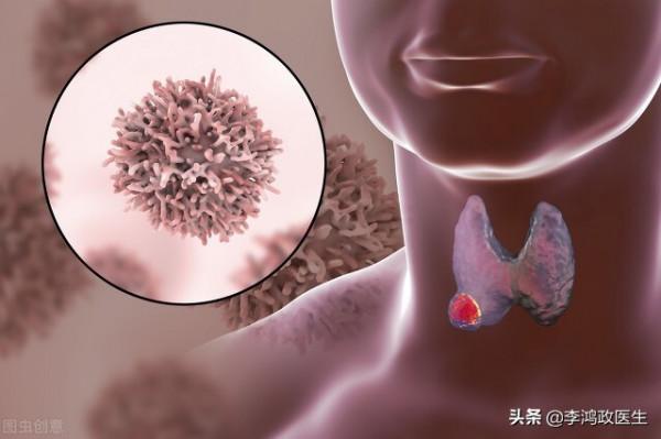 常見癌症的體檢篩查方法，醫生一次性說清：體檢不走彎路