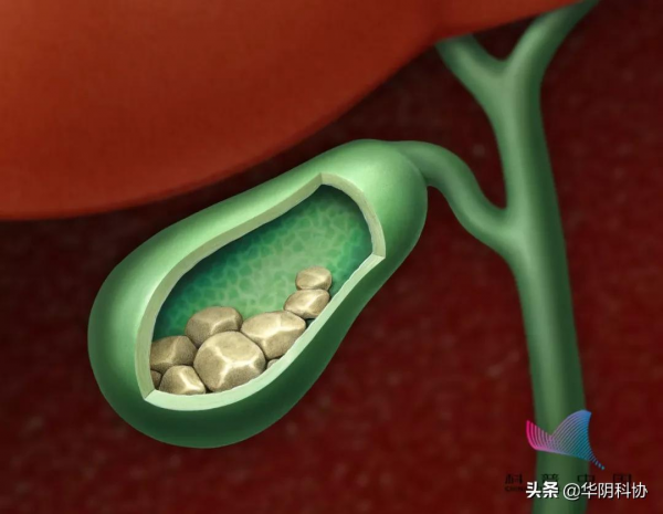 別慌!體檢查出這15種毛病,有些根本不用治! 別慌!體檢查出這15種毛病,有些根本不用治!