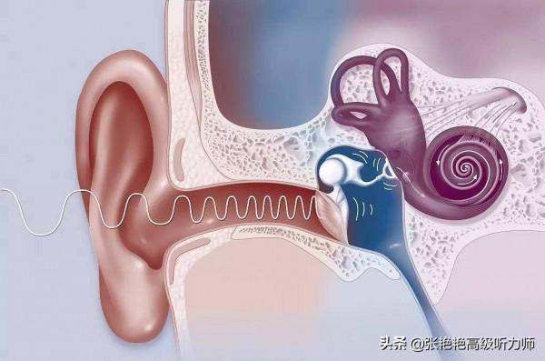 聽見但聽不清，驗配師說言語識別率差，那還有必要佩戴助聽器嗎？