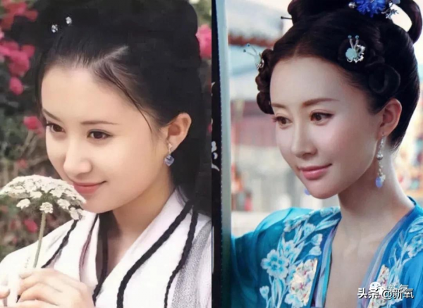 如果早知道整形天花板這件事,舒暢也不至於臉變成這樣... 如果早知道整形天花板這件事,舒暢也不至於臉變成這樣...