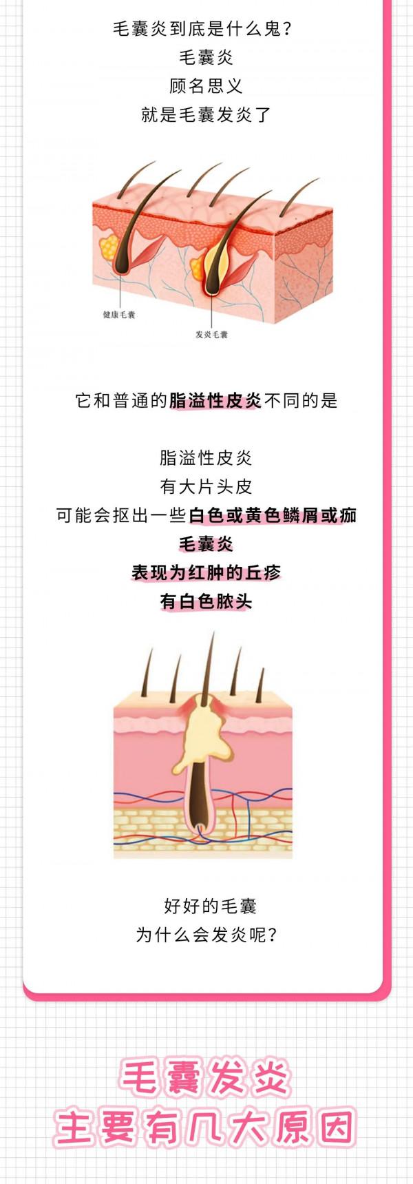 「健康科普」頭皮上為什麼會長小紅疙瘩？