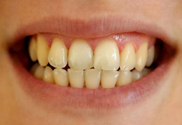 吸菸的3個好處和4個壞處，你瞭解多少？看完你還會吸菸嗎？