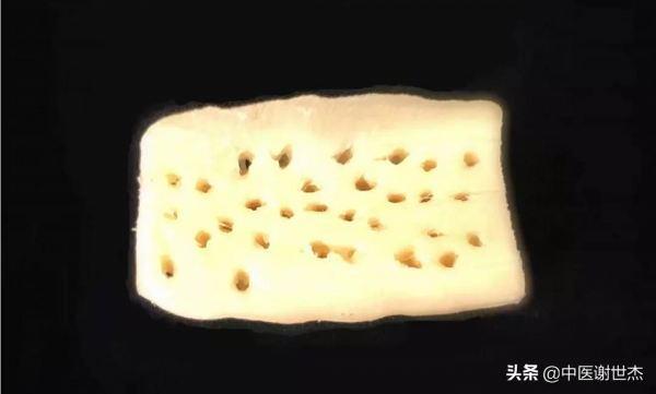 冬日手腳冰涼怎麼辦？試試這兩招