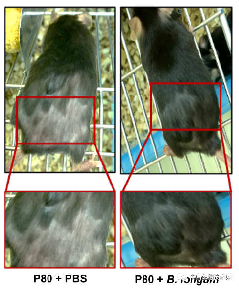 希望來了！“防脫”要補充大豆飲食，一種益生菌或能逆轉“禿頭”