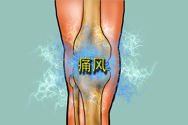 列出尿酸高的三種典型症狀，對照看看，若有，及時改善