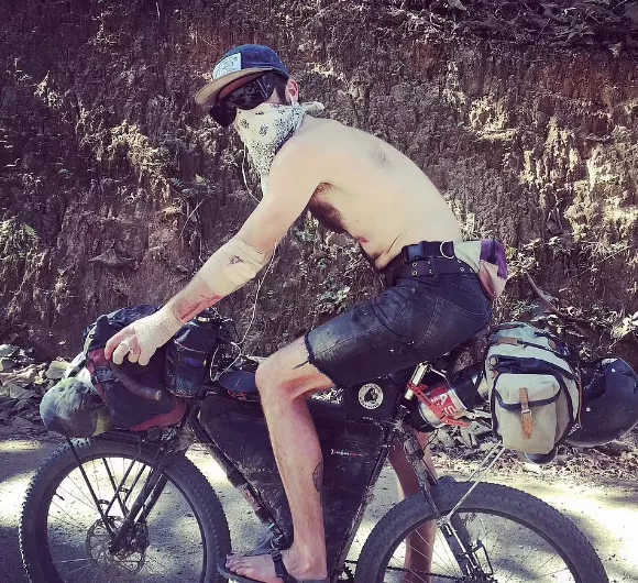 35歲男子訂婚旅行 卻意外染上罕見絕症 大腦&quot&semi;發黴&quot&semi; 比新冠還可怕