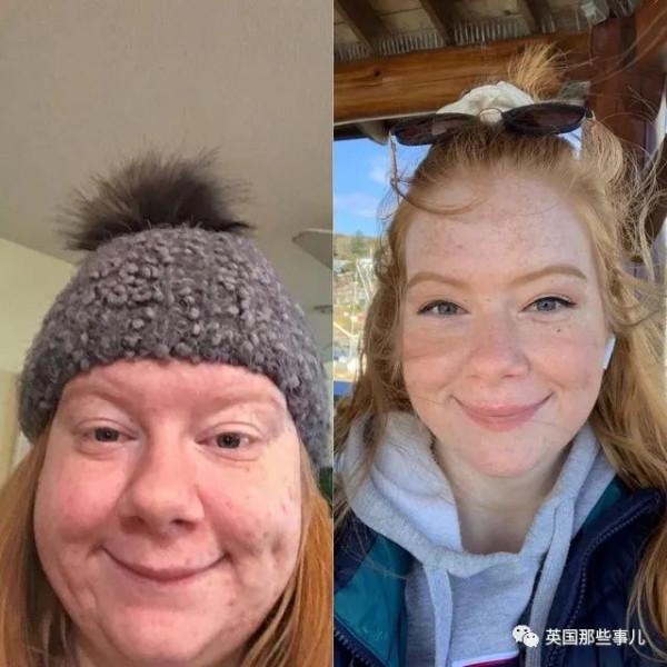 一個姑娘減掉230斤是什麼樣子…對比照驚到我了 一個姑娘減掉230斤是什麼樣子…對比照驚到我了