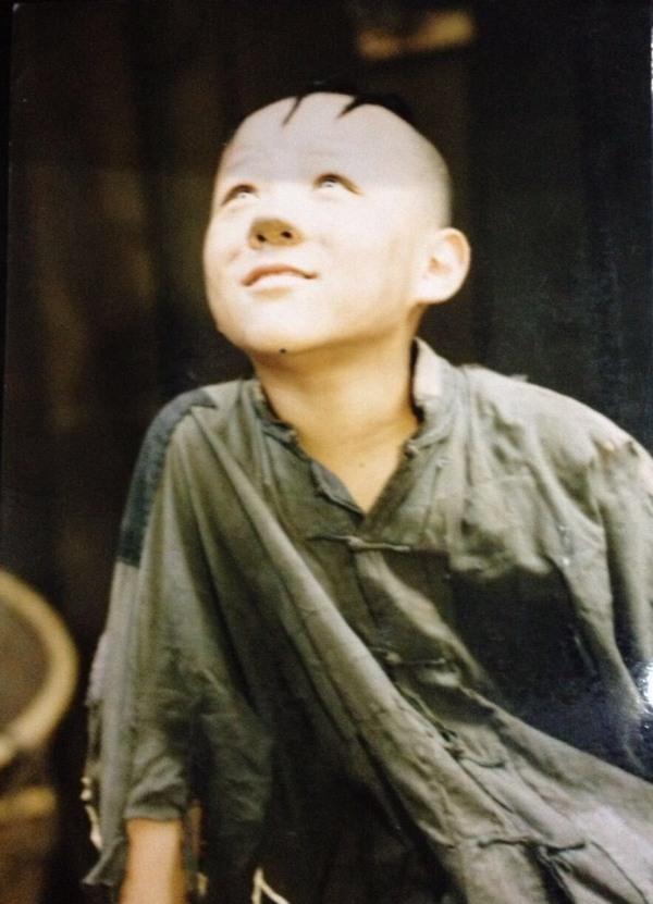 “三毛”長大了!8歲成名,14歲禿頂,34歲變帥哥,植髮挨300多針 “三毛”長大了!8歲成名,14歲禿頂,34歲變帥哥,植髮挨300多針