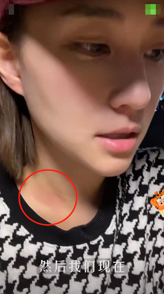 何超蓮帶竇驍吃大排檔，脖頸紅痕搶鏡，疑曝光趙雅芝小兒子戀情