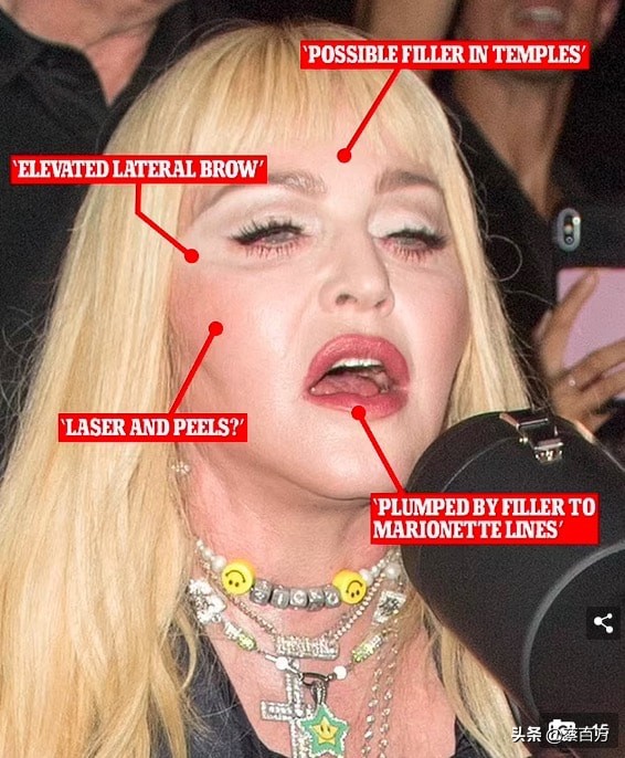 貝嫂番茄炒蛋紅黃配色著裝被嘲像麥當勞叔叔，網友：不要再打針了