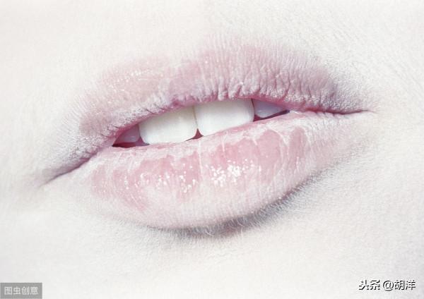 8大症狀提示貧血，發生時有可能已是重度，不重視可能不可挽回