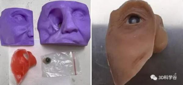 3D數字化技術為面部修復帶來快速、精準解決方案