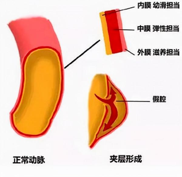 從診斷高血壓到腦出血去世,10年間這位患者經歷了什麼? 從診斷高血壓到腦出血去世,10年間這位患者經歷了什麼?