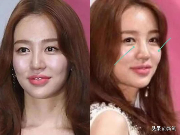 越努力越沒眼看,為什麼南韓女明星個個精緻又腫脹? 越努力越沒眼看,為什麼南韓女明星個個精緻又腫脹?