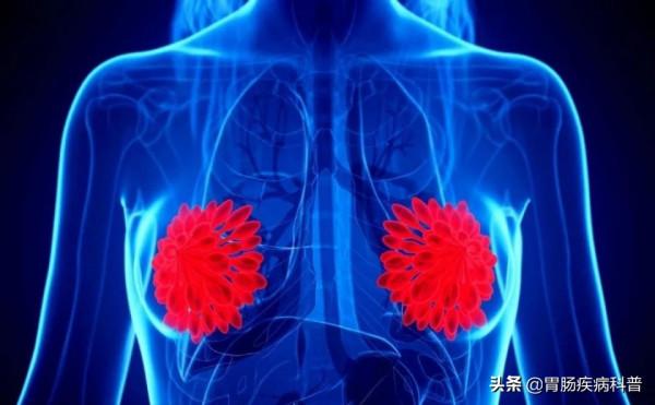 體檢查出囊腫、結節、息肉，啥樣的才是癌症的近親？