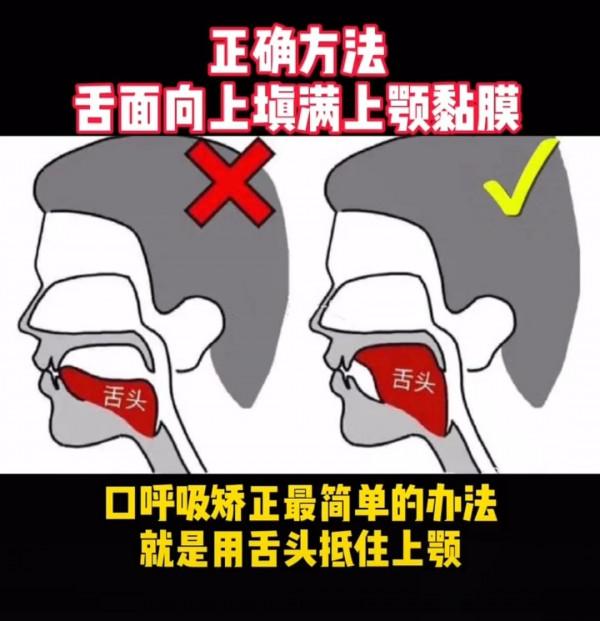 下巴後縮還嘴凸?記住這2招,拒絕變美絆腳石 下巴後縮還嘴凸?記住這2招,拒絕變美絆腳石