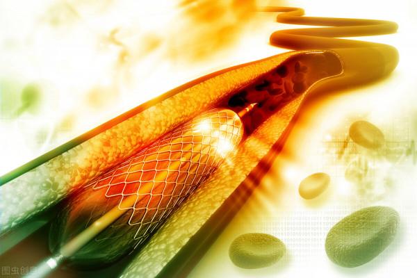 支架降價後，藥物球囊也降至百元，支架和球囊，哪個效果更好？