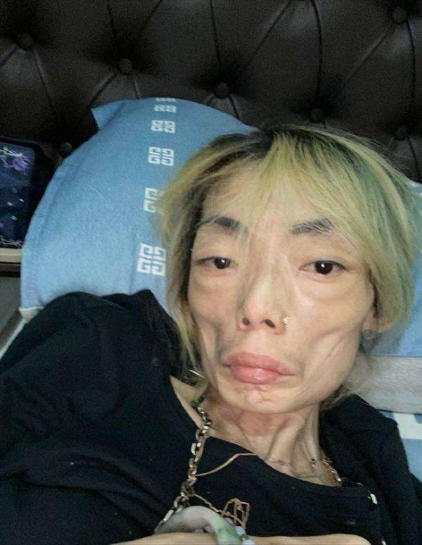 &OpenCurlyDoubleQuote;內卷&rdquo;下暴瘦的10位女星，有人瘦到22公斤，體力不支只能坐輪椅