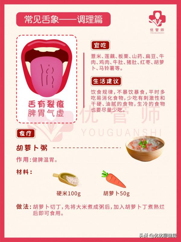 中醫舌診：不同舌相代表著什麼健康問題，如何對症調理？全告訴你