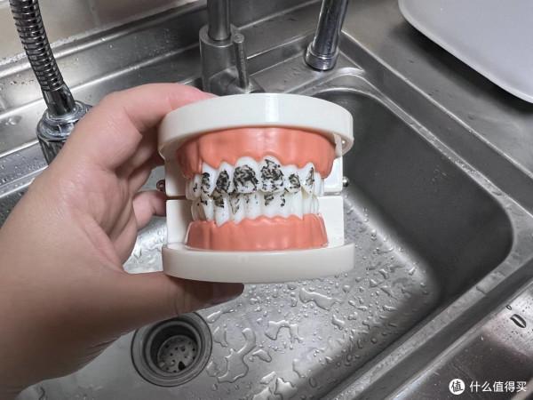 水牙線到底是不是智商稅?日常口腔護理應該注意什麼? 水牙線到底是不是智商稅?日常口腔護理應該注意什麼?