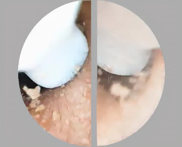 小米有品的掏耳勺火了,500W畫素看得清清楚楚,掏得明明白白 小米有品的掏耳勺火了,500W畫素看得清清楚楚,掏得明明白白