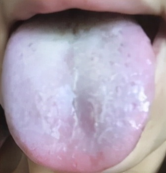 肝鬱脾虛、痰多腹脹、氣不順？四味藥，疏肝健脾、化痰溼、通氣機