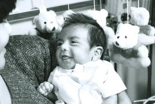 80年代，美國一母親為了救女兒，冒險移植狒狒心臟，結果怎樣？