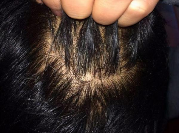 兩味中藥，健脾祛溼，先補後通，升清濁降，開合有度，脾胃得佳